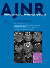 American Journal of Neuroradiology: 39 (3)