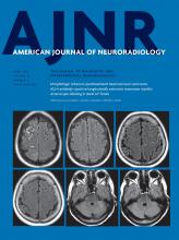 American Journal of Neuroradiology: 39 (4)