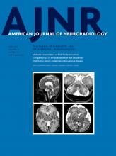 American Journal of Neuroradiology: 39 (6)