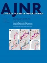 American Journal of Neuroradiology: 39 (7)