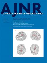 American Journal of Neuroradiology: 39 (8)
