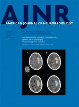 American Journal of Neuroradiology: 39 (9)