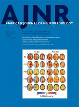 American Journal of Neuroradiology: 40 (1)