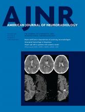 American Journal of Neuroradiology: 40 (10)