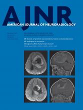 American Journal of Neuroradiology: 40 (11)