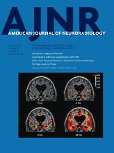 American Journal of Neuroradiology: 40 (8)