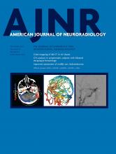 American Journal of Neuroradiology: 40 (9)