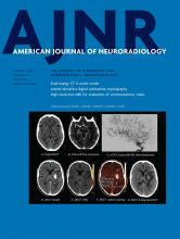 American Journal of Neuroradiology: 41 (1)
