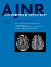 American Journal of Neuroradiology: 41 (10)