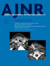 American Journal of Neuroradiology: 41 (11)