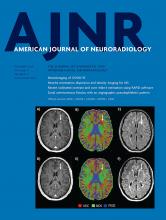 American Journal of Neuroradiology: 41 (12)