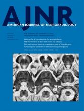 American Journal of Neuroradiology: 41 (5)