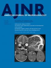American Journal of Neuroradiology: 41 (7)