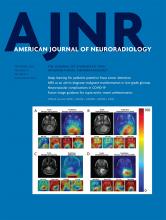 American Journal of Neuroradiology: 41 (9)