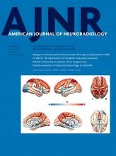 American Journal of Neuroradiology: 42 (12)