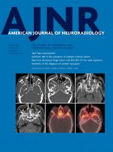 American Journal of Neuroradiology: 42 (3)