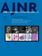 American Journal of Neuroradiology: 42 (9)