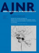 American Journal of Neuroradiology: 43 (1)