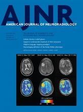 American Journal of Neuroradiology: 43 (10)