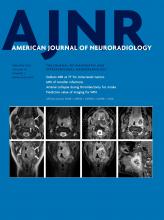 American Journal of Neuroradiology: 43 (2)