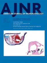 American Journal of Neuroradiology: 43 (3)