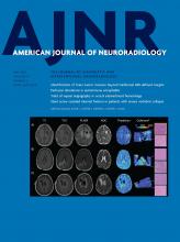 American Journal of Neuroradiology: 43 (5)
