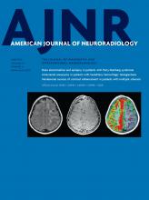 American Journal of Neuroradiology: 43 (6)