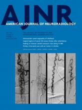 American Journal of Neuroradiology: 43 (7)