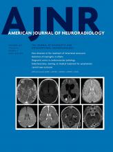 American Journal of Neuroradiology: 43 (9)