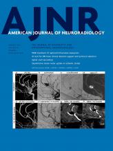 American Journal of Neuroradiology: 44 (1)