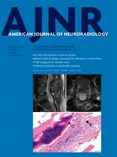 American Journal of Neuroradiology: 44 (2)