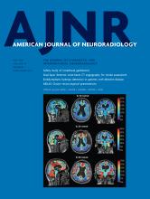 American Journal of Neuroradiology: 44 (5)