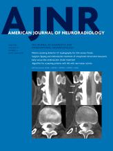 American Journal of Neuroradiology: 44 (6)