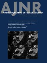 American Journal of Neuroradiology: 44 (9)