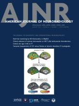 American Journal of Neuroradiology: 45 (1)