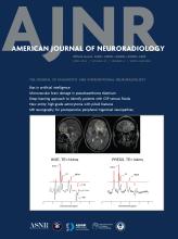 American Journal of Neuroradiology: 45 (4)